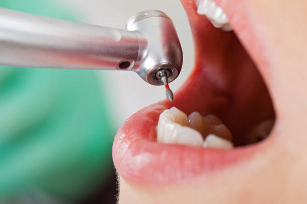 Best Emergency Dental Surgery in Four Corners, TX